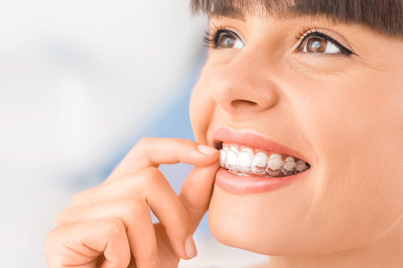 Orthodontics in Cypress